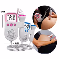 doppler fetal